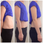 DR improvement